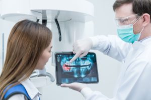 Radiografia endorale ai fosfori