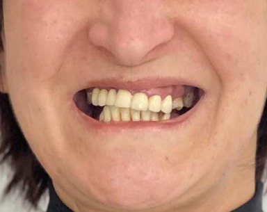 Sorriso prima del trattamento