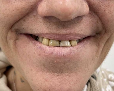 Sorriso prima del trattamento