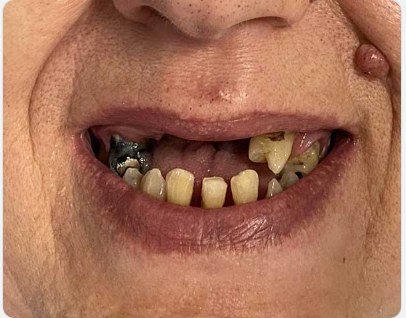 Sorriso prima del trattamento