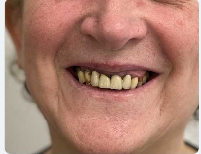 Sorriso prima del trattamento