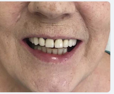 Sorriso prima del trattamento